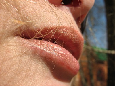 שפתיים סדוקות