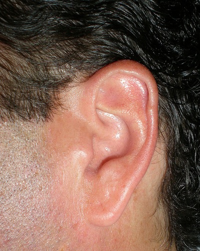 אוזניים